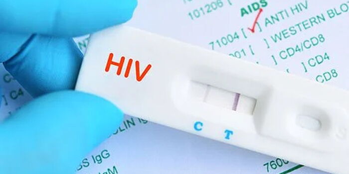 New HIV Prevention Drug Needs Only Two Yearly Injections